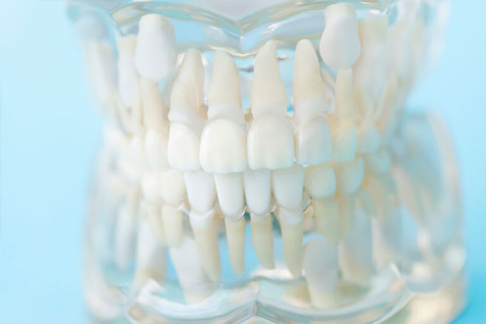 成人矯正の必要性が低くなる！