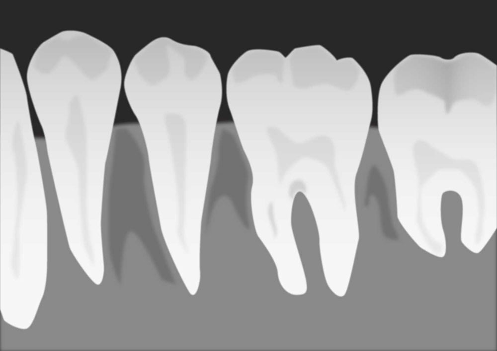 レントゲン検査