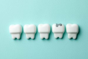 黄緑の背景の前に歯の模型がある