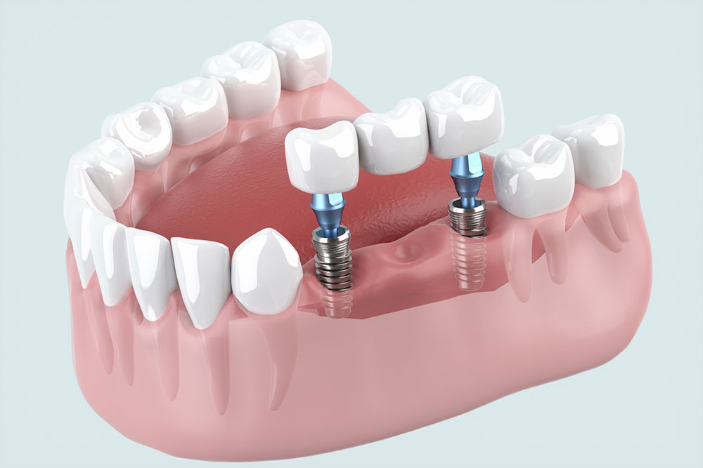 失われた機能と美しさを取り戻す