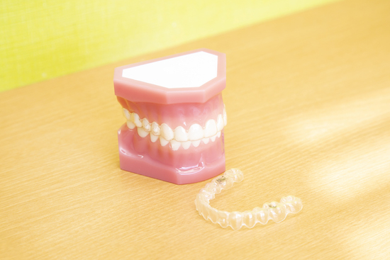 インビザラインのイメージ